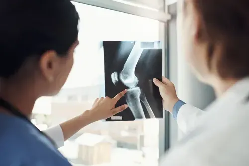 What are the 3 Most Common Sites for an Avulsion Fracture?